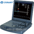 Ultra-som do portátil do equipamento médico 3D &amp; doppler da cor